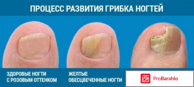 Лоцерил отзывы покупателей отрицательные отзывы