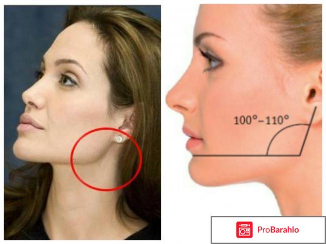 Melannett отзывы отрицательные отзывы