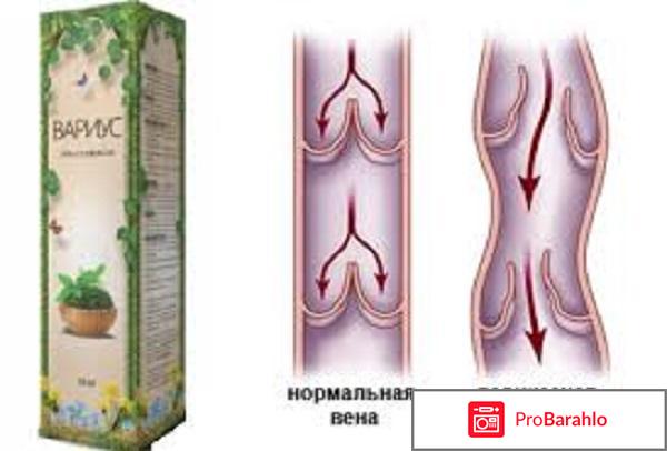 Вариус отзывы покупателей отрицательные отзывы