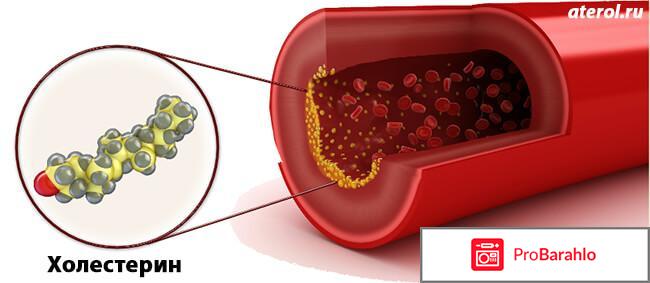 Атерол (Aterol) отзывы владельцев