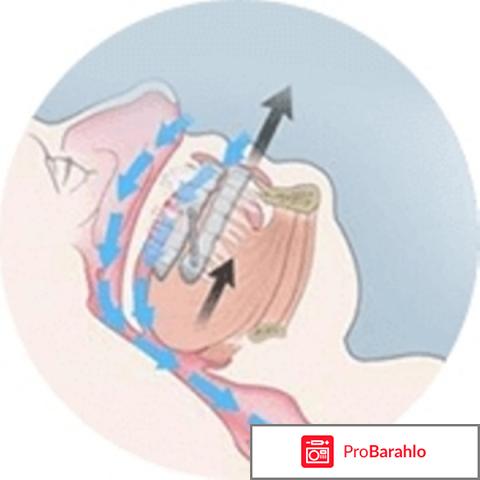 Minusnor спрей от храпа: цена, отзывы, купить Минуснор отрицательные отзывы