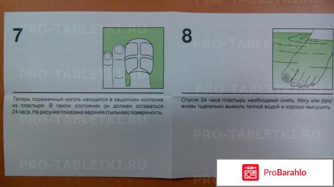 Набор микоспор отрицательные отзывы