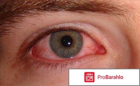 Тетрациклин мазь инструкция по применению цена отзывы отрицательные отзывы