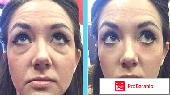 Instantly ageless отзывы обман