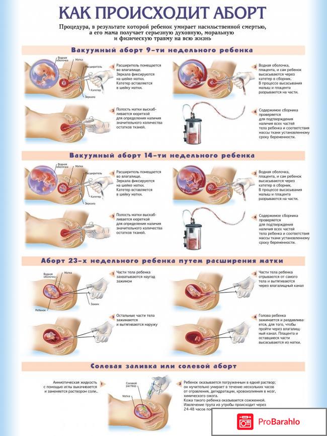 Мини аборт отрицательные отзывы