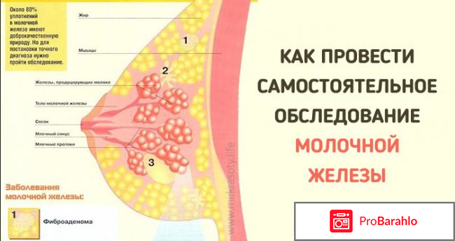 Как обследовать грудную железу самостоятельно 