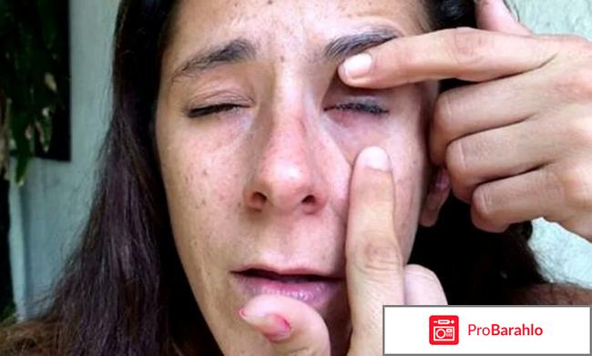 Что делать если супер клей попал в глаз отрицательные отзывы