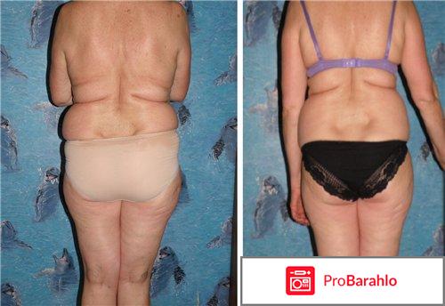 Бальзам гель лошадиная сила релаксирующий отзывы отрицательные отзывы