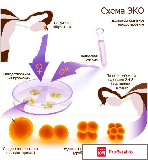 Последствия после эко для организма женщины отзывы отрицательные отзывы