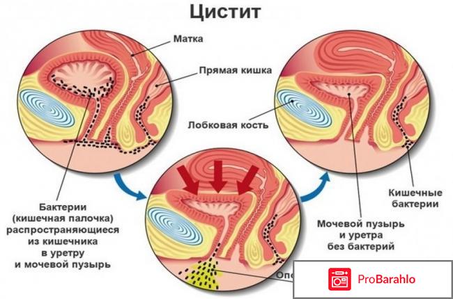 Монурал побочные действия обман