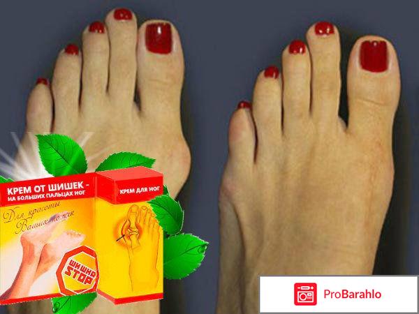 Шишка стоп отзывы форум отрицательные отзывы