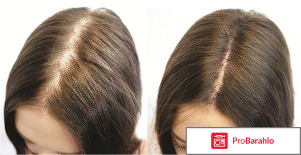 Масло для роста волос отзывы 