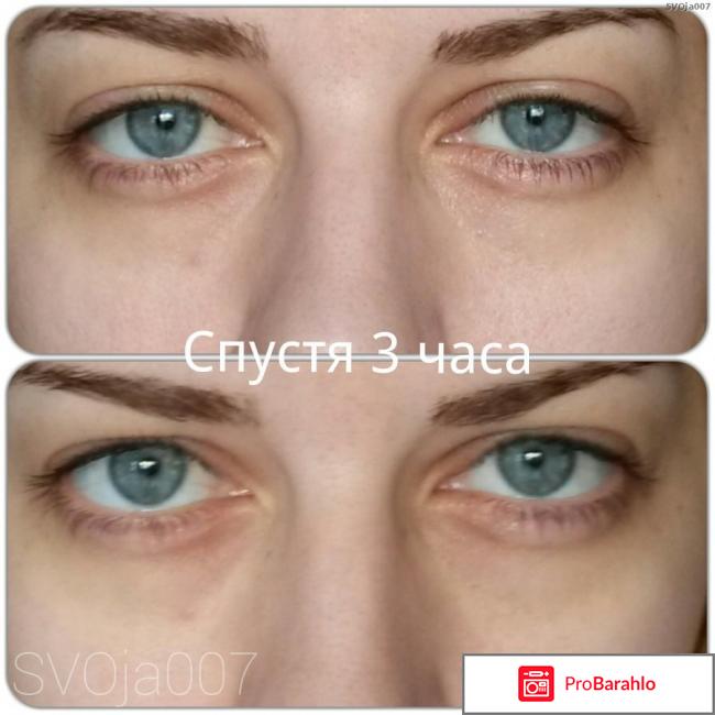 Гепариновая мазь от мешков под глазами отрицательные отзывы