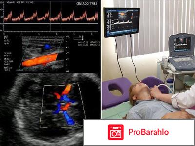Узи брахиоцефальных сосудов головы и шеи что показывает отрицательные отзывы