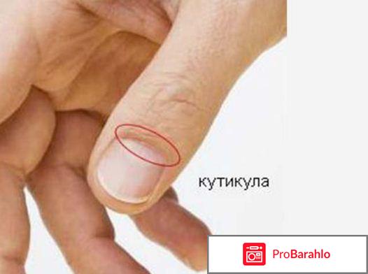 Ремувер что это отрицательные отзывы