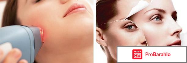 Лазерное омоложение лица отзывы фото 