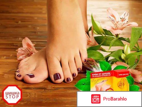 Шишка стоп отзывы форум обман