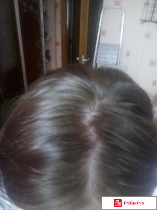 Шампунь против перхоти Кето Плюс обман