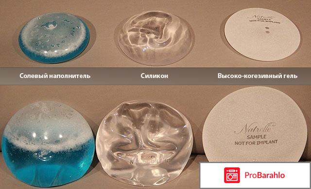 Импланты отзывы 