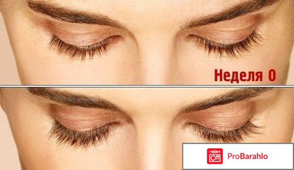 Карепрост для ресниц отзывы фото обман