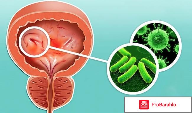 Лечение цистита у женщин отзывы форум отрицательные отзывы