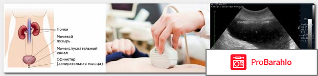 Вредно ли узи обман