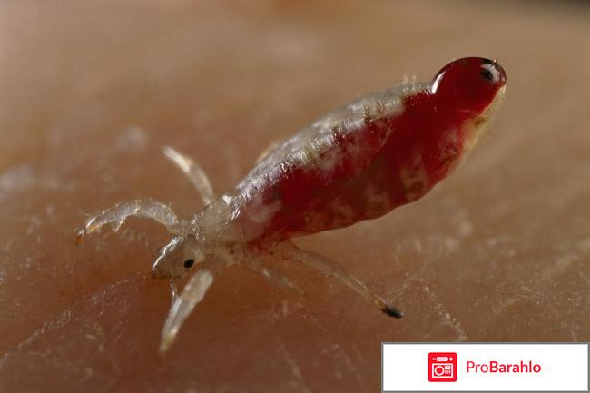 Как вывести вшей в домашних условиях у детей? отрицательные отзывы