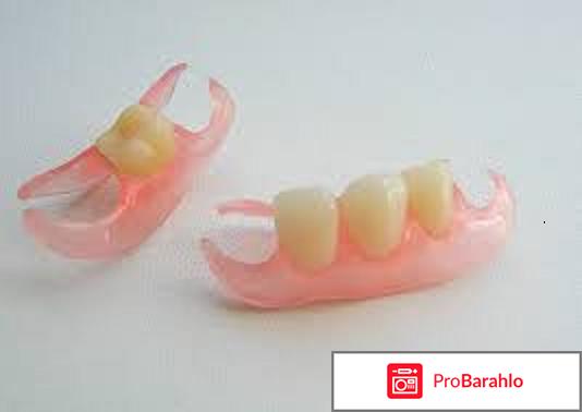 Зубной протез бабочка отрицательные отзывы