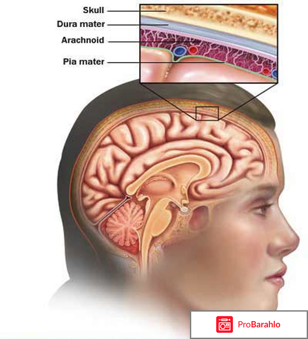 Причины, симптомы, профилактика и лечение менингита обман