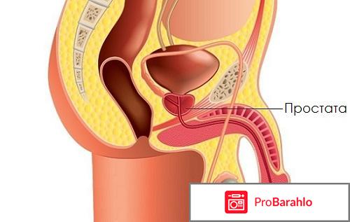 Как делать непрямой массаж простаты? отрицательные отзывы