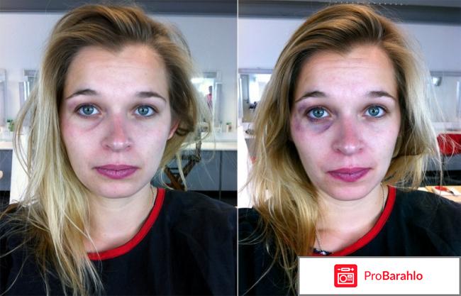 Бадяга 911 отзывы отрицательные отзывы