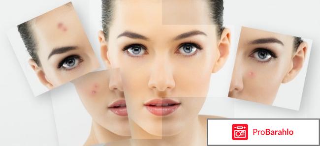 Крем гель циновит от прыщей обман