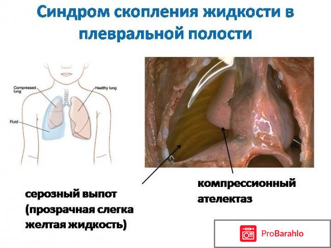 Мила левчук отрицательные отзывы обман