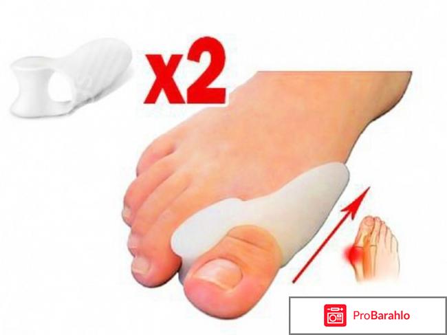 Вальгус про 