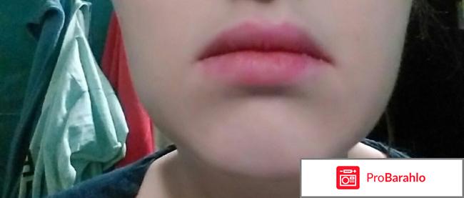 ROMANTIC BEAR обман