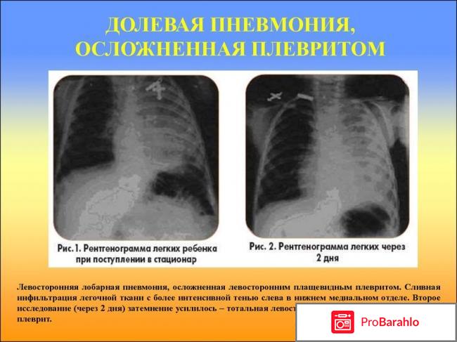 Ольга юрковская отрицательные отзывы 