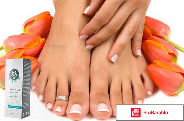 Варанга от грибка, отзывы отрицательные отзывы