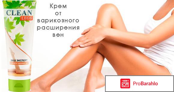 Купить крем от варикоза 