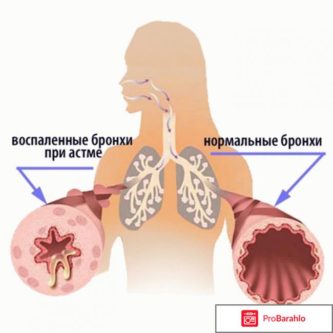 Сингуляр отзывы врачей отрицательные отзывы
