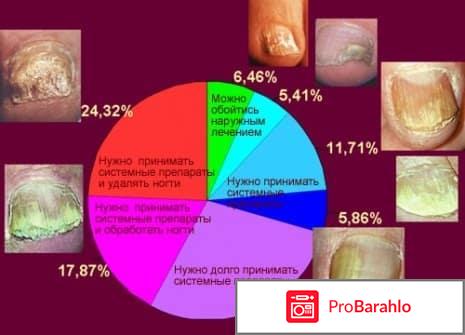 Наносим лак от грибка ногтей обман