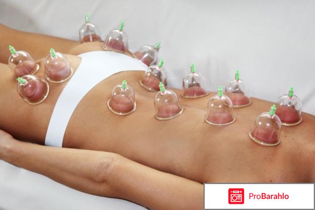 Баночный массаж отзывы фото до и после 