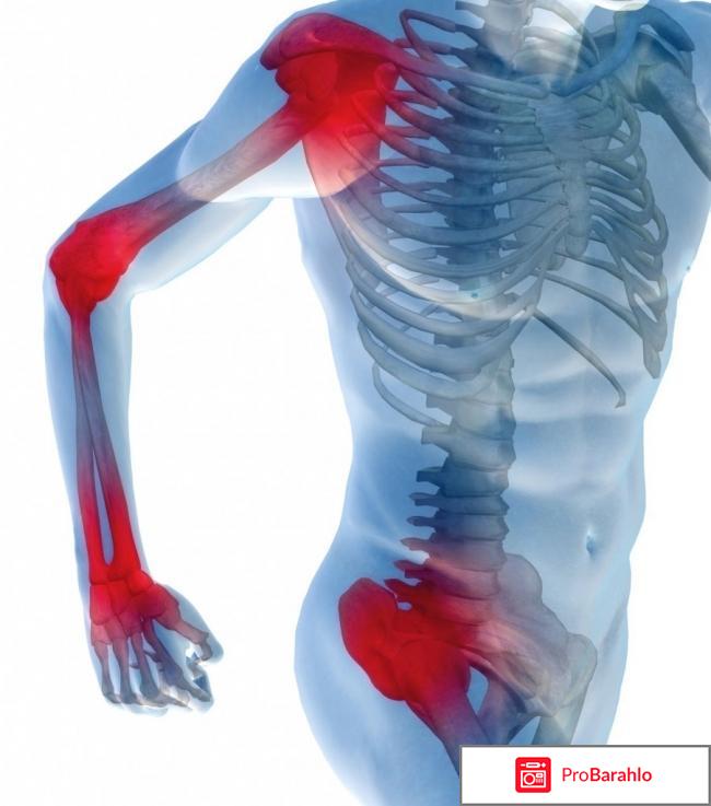 Лошадиный бальзам цена для суставов отрицательные отзывы