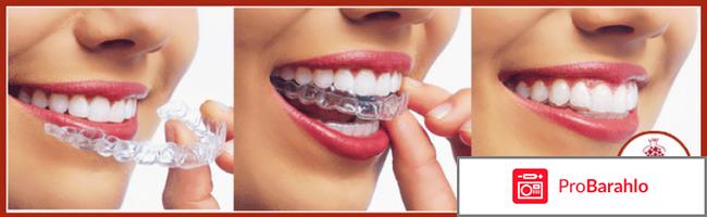 Капы для выравнивания зубов фото 