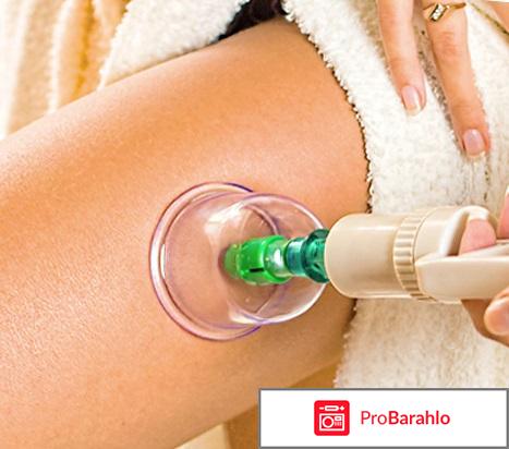 Вакуумные банки от целлюлита отзывы 