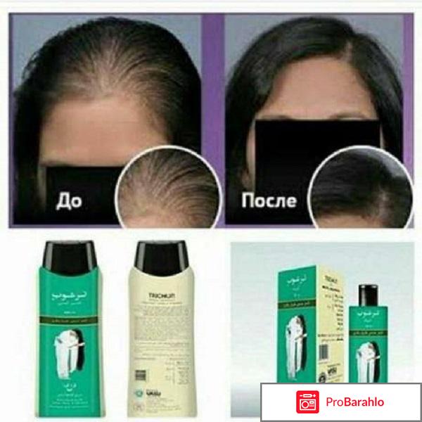 Тричуп шампунь отзывы обман