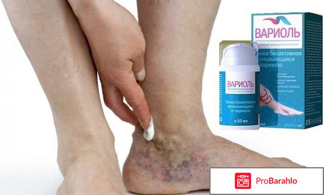 Вариоль - пенка от варикоза реальные отзывы