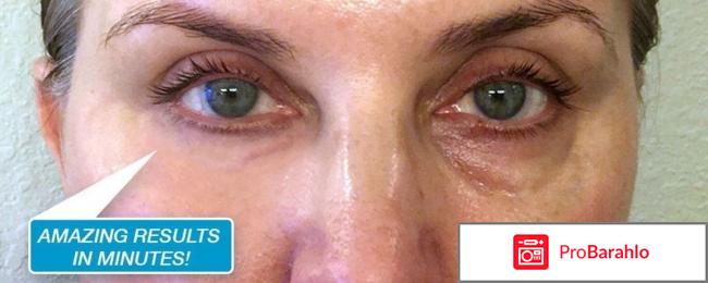 Крем от морщин ageless отрицательные отзывы