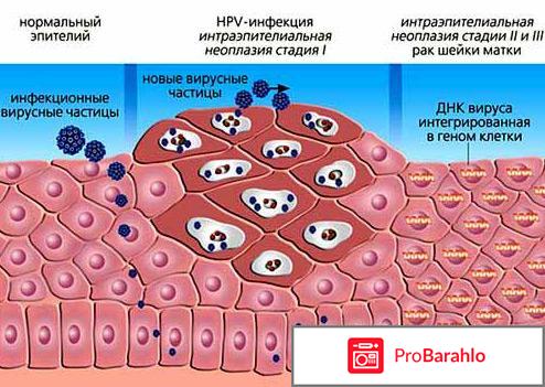 Впч обман