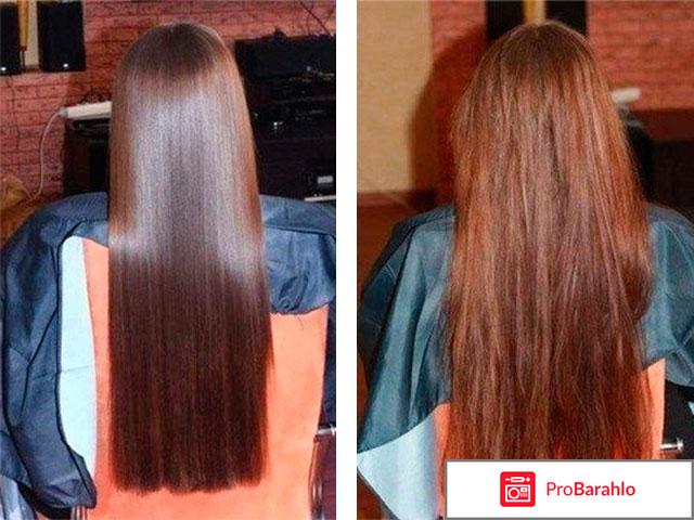 Народные средства от выпадения волос отзывы 