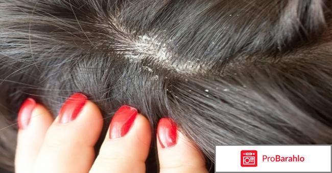 Микозорал шампунь цена отзывы отрицательные отзывы